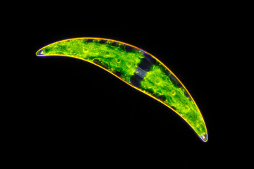 Microscopic view of freshwater single-celled green algae (Closterium). Darkfield illumination.