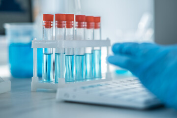 A female researcher sits at a workplace in a laboratory, behind a personal computer monitor. Against the background research statistics. Pharmaceutical medical worker in protection works at keyboard.