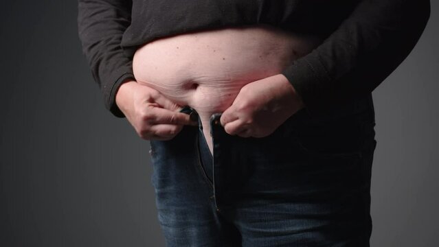 Overweight heavy elderly woman pinching her belly fat, overeating problem, obesity. Weight people having more body fat than is optimally, body mass index, unhealthy concept
