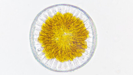A marine phytoplankton, Campylodiscus sp. Marine diatom. Live cell. 40x objective lens. Stacked...