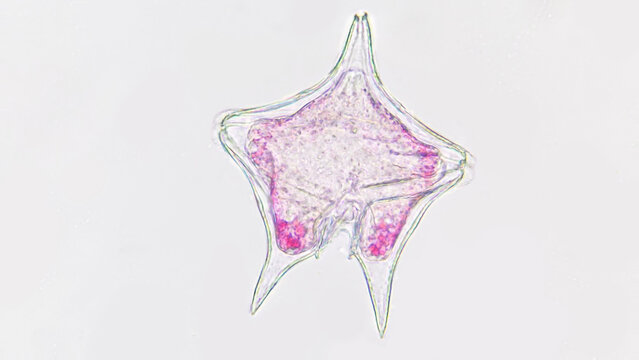 A marine phytoplankton with pink chlorophyll,  Protoperidinium sp. Live cell. 40x objective lens. Stacked image
