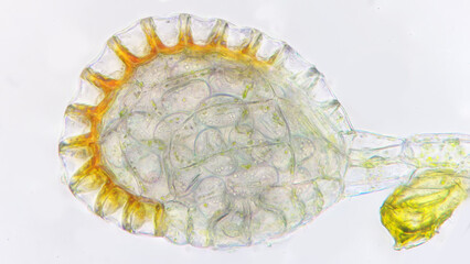 Fern sporangium under light microscope. 400x magnification. Focus stacked image