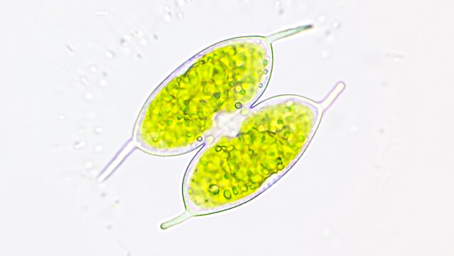 Freshwater green microalgae, Staurodesmus convergens. 40x objective lens. Live cell. Selective focus