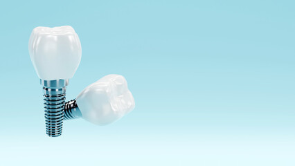 Tooth and dental implant for stomatology set, Implants surgery concept, 3D rendering