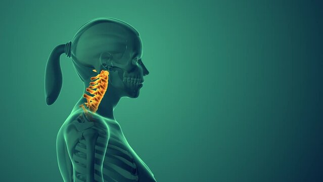 Neck discomfort or cervical postural syndrome