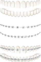 Teeth Braces Set