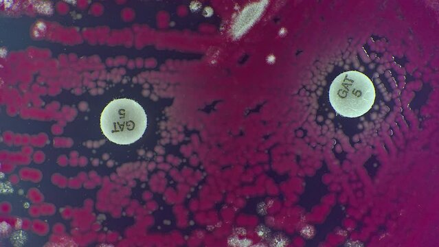 Bacterial colonies are grown in a Petri dish to test for antibiotic resistance. timelapse
