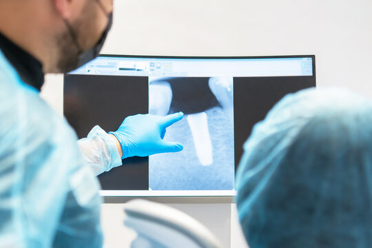 Dentist doctor showing for female patient x-ray with plan and result of treatment.