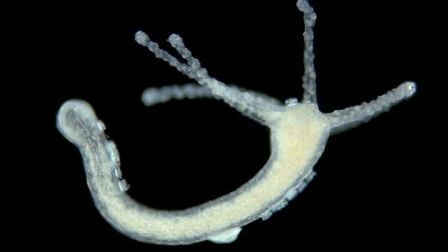 Freshwater Hydra, class Hydrozoa and Infusoria Ciliophora Kerona polyporum, family Oxytrichidae under microscope. In video, they move around body of Hydra and are commensal.