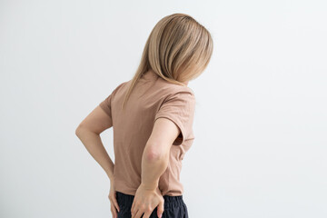 Spine osteoporosis. Scoliosis. Spinal cord problems on woman's back. - obrazy, fototapety, plakaty