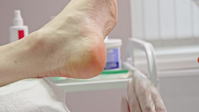 Podiatrist doctor, performs the procedure of treating a woman's legs. Cosmetic procedures of the feet