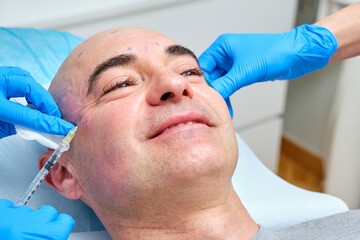 mature man over 40 years old getting anti wrinkle treatment on his face with botulinum toxin