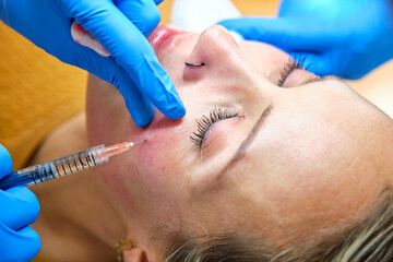 injecting hyaluronic acid into the face of a 40-year-old woman with a syringe with a cannula
