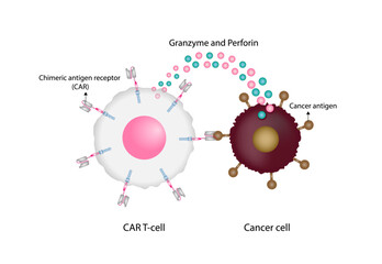 CAR T-cell therapy and Cancer treatment . Chimeric antigen receptor T cells. T cell receptor proteins that have been engineered to kill cancer ells. CAR T cells immunotherapy. Cancer therapy. Vector