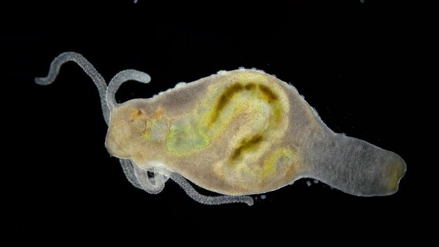 Hydra, Hydrozoa and Infusoria Kerona polyporum, Trichodina under microscope. They move around body of Hydra and are commensal. It can be seen that she ate Chironomidae larva