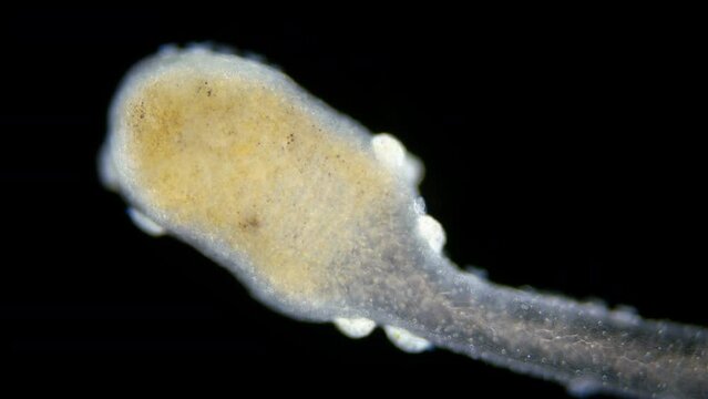 Freshwater Hydra, Hydrozoa and Infusoria Kerona polyporum, family Oxytrichidae, Trichodina under microscope. In video, they move around body of Hydra and are commensal.