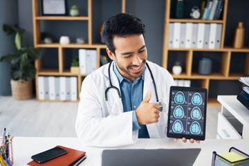 Video call, x ray and doctor with brain scan on tablet for telehealth, online consulting and patient results. Healthcare tech, communication and man on computer for medical care, neurology or service