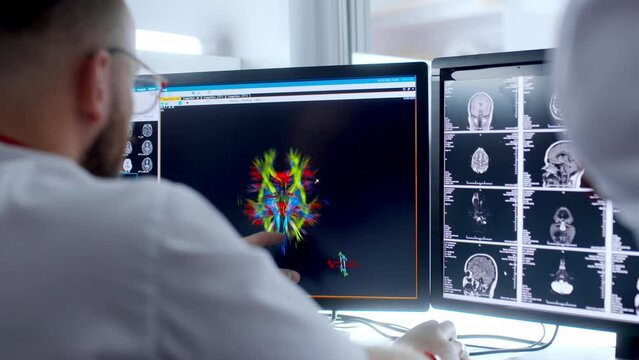 Medical hospital: neurologist use computer, analyze patient's MRI, diagnose brain. Health Clinic Lab: A professional doctor examines a functioning CT scan