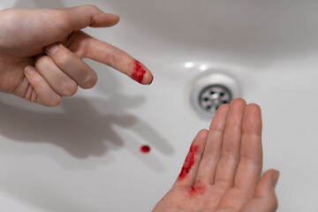 Close-up of a woman's cut finger in blood over the sink