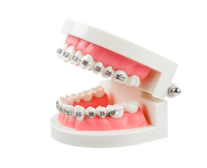 The Teeth model with metal wire dental braces or dental instruments isolated on white background, Save clipping path.
