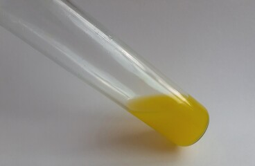 bulb with yellow liquid. chemical experiments. medicine, scientific experiments.
