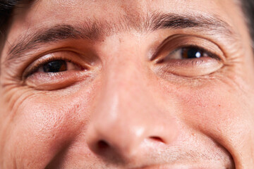 Obraz premium Young man with strabismus smiling positively at the camera.