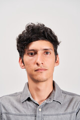 Obraz premium Young man with cataract in his eye looking seriously at the camera.