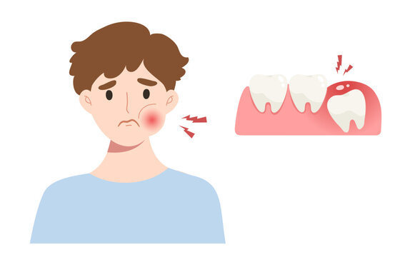 Young man suffering from wisdom tooth. Concept of impacted tooth pain, dentistry, dental illustration, oral health, toothache. 