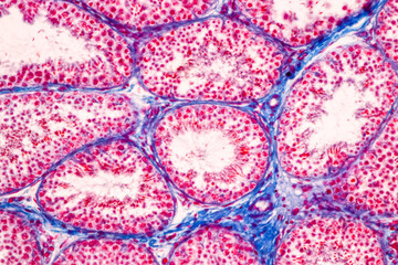 Anatomy and Histological Epididymis and Testis human cells under microscope.