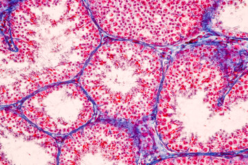 Anatomy and Histological Epididymis and Testis human cells under microscope.