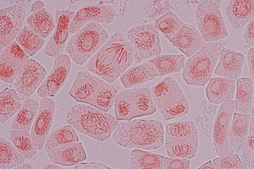 Root tip of Onion and Mitosis cell in the Root tip of Onion under a microscope.	