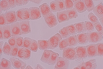 Root tip of Onion and Mitosis cell in the Root tip of Onion under a microscope.	
