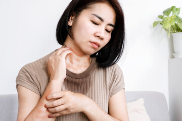 Asian woman scratching on her sweat and itchy skin allergic to hot weather in summer