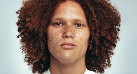 Portrait of a handsome man with freckles and an afro looking at the camera