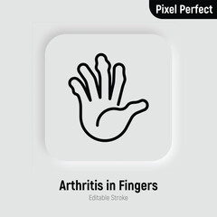 Arthritis in fingers thin line icon. Inflammation in joints. Osteoarthritis. Pixel perfect, editable stroke. Vector illustration.