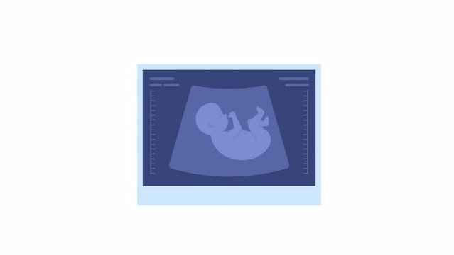 Animated pregnancy ultrasound. Prenatal test. Baby sonogram. Flat cartoon style icon 4K video footage. Color isolated object animation on white background with alpha channel transparency