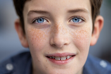 Close-up portrait of a teenage boy with blue eyes and a blue shirt, a child smiling and looking at the camera with freckles on his skin and braces on his teeth.