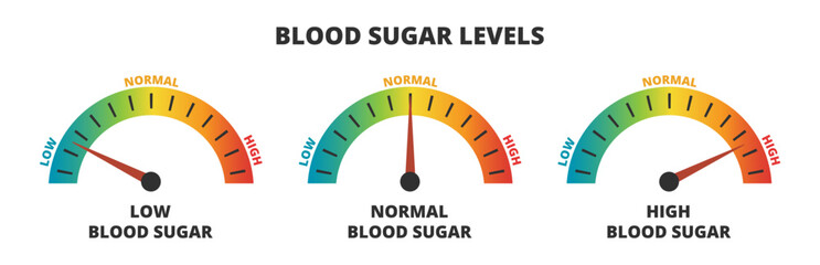 Vector infographic set of blood sugar levels – glucose meters with low, normal, and high level results, diabetes, prediabetes. Indicator gauge with color scale and arrow showing blood sugar levels.