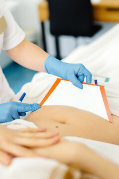 Medical worker prepared abdomen of person for sculputing body