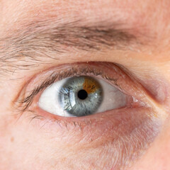 Macro of a male eye with heterochromia