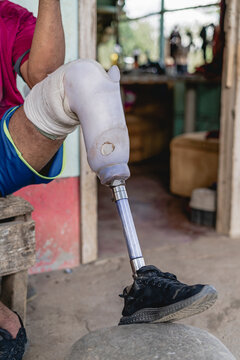 One-leg prosthesis. 