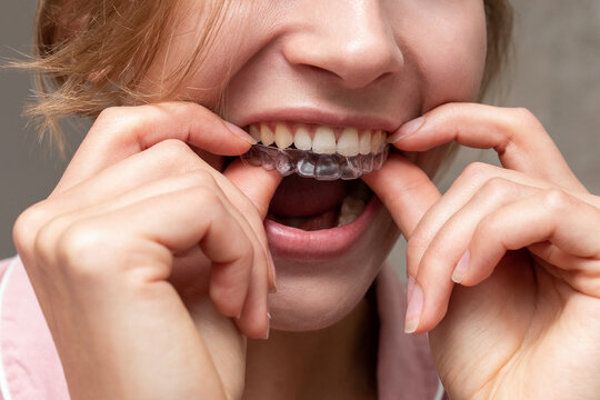 Face of woman with perfect teeth
