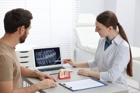 Doctor showing patient X-ray picture and educational model of dental implant in clinic