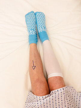 UGC patient&rsquo;s legs before surgery 