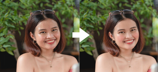 Example of Beauty AI filter application. A photo of a woman with pimples and slight wrinkles removed, nose reduction, and some makeup applied. - obrazy, fototapety, plakaty