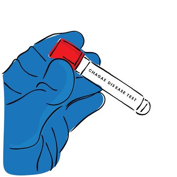 Hand Holding A Tube For Chagas Disease Test