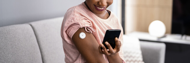 Woman Testing Glucose Level With Continuous Glucose Monitor - obrazy, fototapety, plakaty