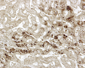 Liver. Hepatocyte. Lipid droplets. Tissue fixed in osmium tetroxide