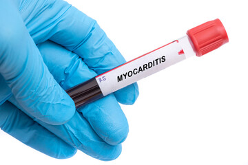 Myocarditis. Myocarditis disease blood test in doctor hand