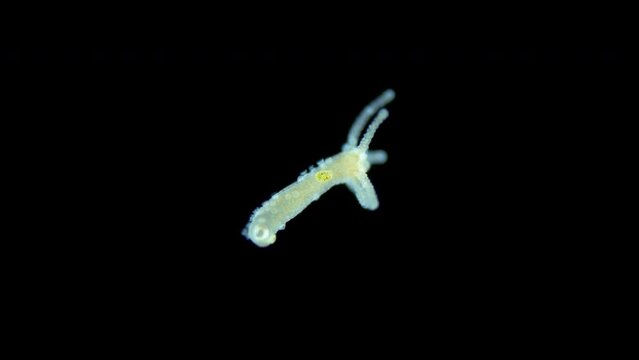 Freshwater Hydra, Hydrozoa and Infusoria Kerona polyporum, family Oxytrichidae, Trichodina under microscope. In video, they move around body of Hydra and are commensal.